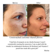 Hyaluron 3D Hydrator Multi Lamellar Emulsion The Advanced Response Face and Neck Cream-Serum with Matrixyl 3000 and Argireline Amplified