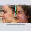 Hyaluron 3D Hydrator Multi Lamellar Emulsion The Advanced Response Face and Neck Cream-Serum with Matrixyl 3000 and Argireline Amplified